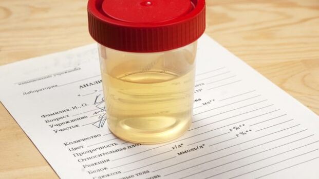 Urinary analysis for arterial hypertension